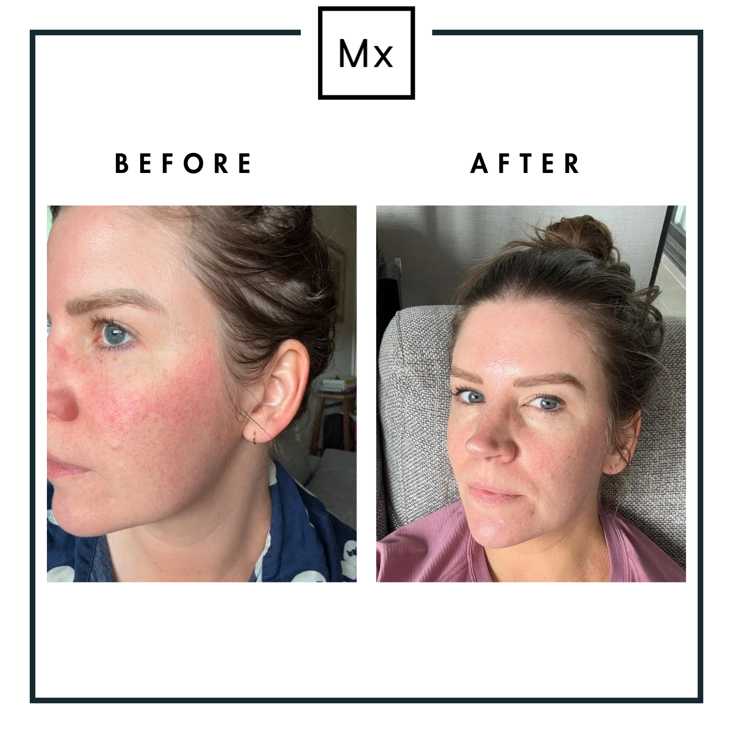 PIGMENTATION COSMECEUTICAL SOLUTION